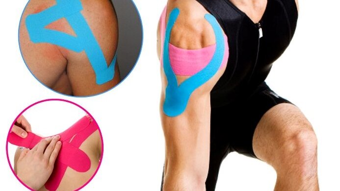 Eine Person trägt farbige Kinesio-Tapes an Schulter, Hüfte und Oberschenkel. Die Bildcollage zeigt verschiedene Tape-Anlagen, wie sie in der Physiotherapie genutzt werden, um Muskeln zu unterstützen und Schmerzen zu lindern. Das Bild dient zur Darstellung der physiotherapeutischen Leistungen im Aktiv Sporthotel in Pirna.